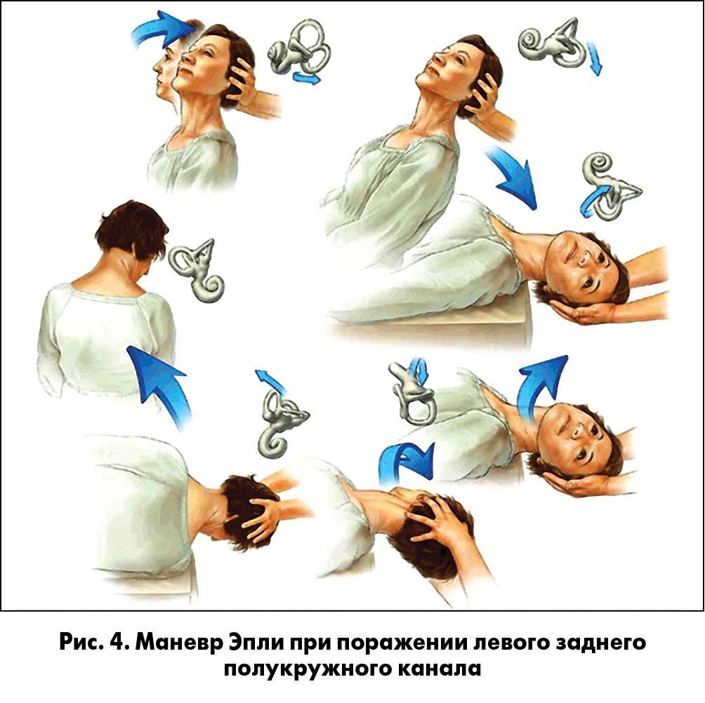 Фотография выполнения маневра Эпли