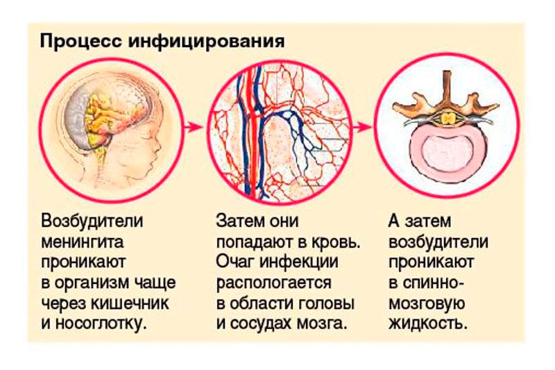 Схема воспалительного каскада при менингите