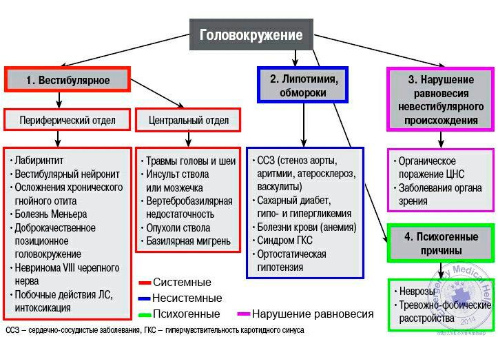 Сравнительная схема различных причин головокружения
