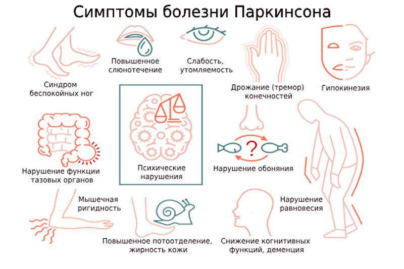 «Диагноз болезни Паркинсона ставится клинически — на основе осмотра и ответа на леводопу»