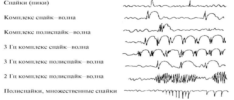 ээг