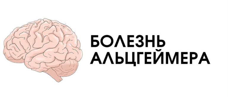 Болезнь Альцгеймера: симптомы, стадии, диагностика, лечение и профилактика