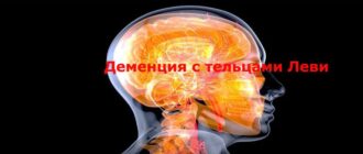 Деменция с тельцами Леви: симптомы, диагностика, лечение и прогноз заболевания